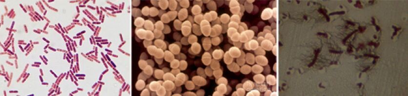 E. coli, enterococos fecais e Proteus son as principais causas de prostatite bacteriana crónica
